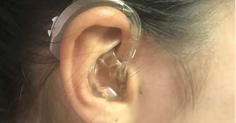 hearing aid in the ear of a person with dark hair.